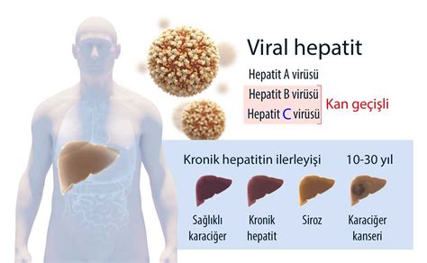 hepatit c hastalığı